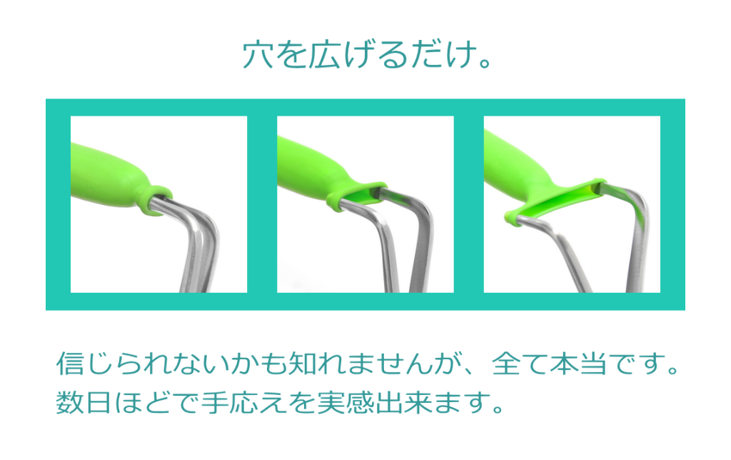 【必見】キトー君の正しい使い方と抑えておきたいポイントまとめ