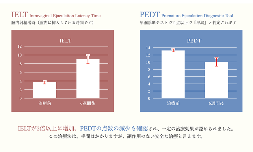 TENGAで早漏改善できるメンズトレーニングカップキープトレーニングの使用感レビュー！